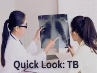 Tuberculosis overview